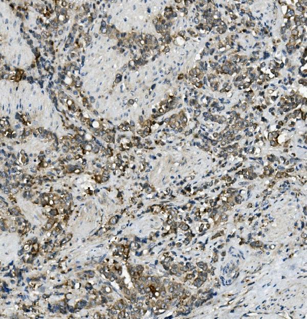 Anti-MRP5/ABCC5 Antibody Boster Bio