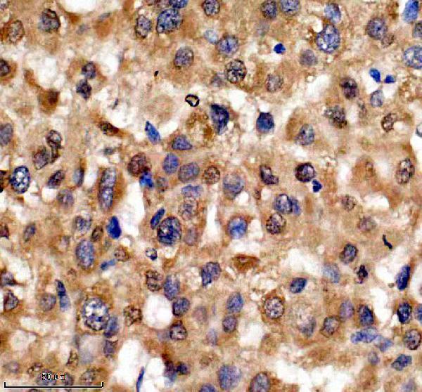 Boster A03051-3 IHC 6 image