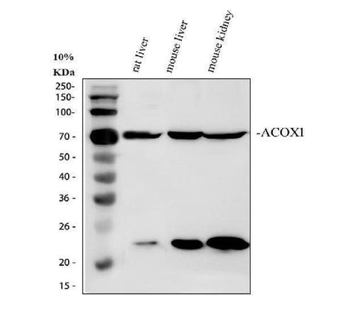 Anti-ACOX1 Antibody Picoband® Boster Bio