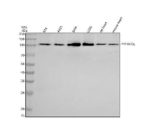Anti-iASPP/PPP1R13L Antibody Picoband® Boster Bio