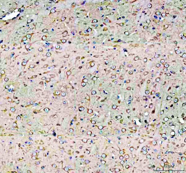 Anti-DYNC1H1 Antibody Boster Bio