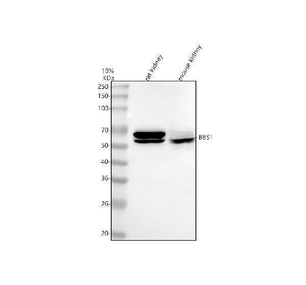 Anti-BBS1 Antibody Picoband® Boster Bio