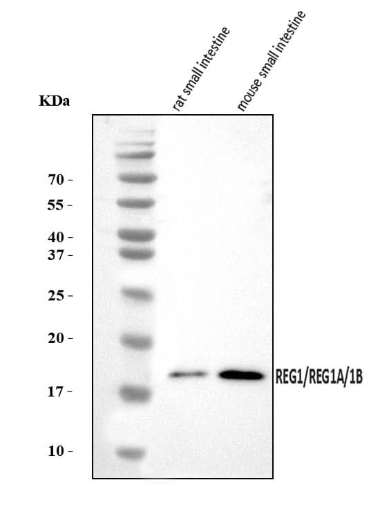 Anti-REG1A/1B Antibody Picoband® Boster Bio