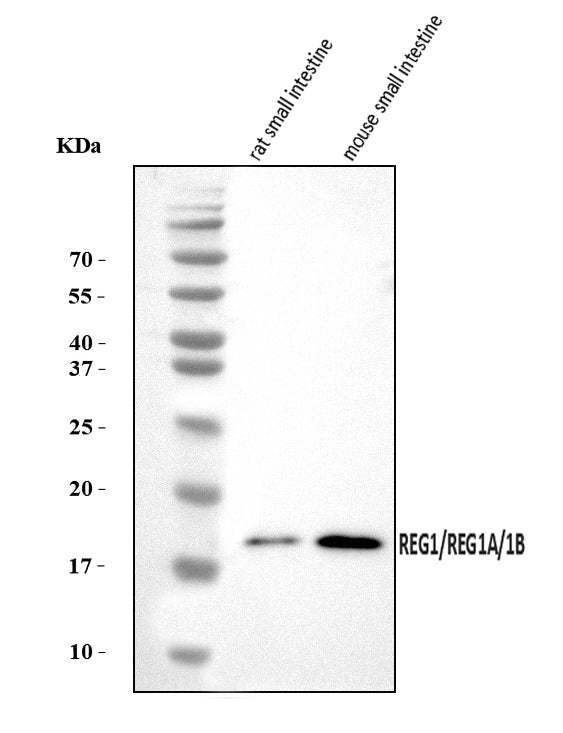 Anti-REG1A/1B Antibody Picoband® Boster Bio