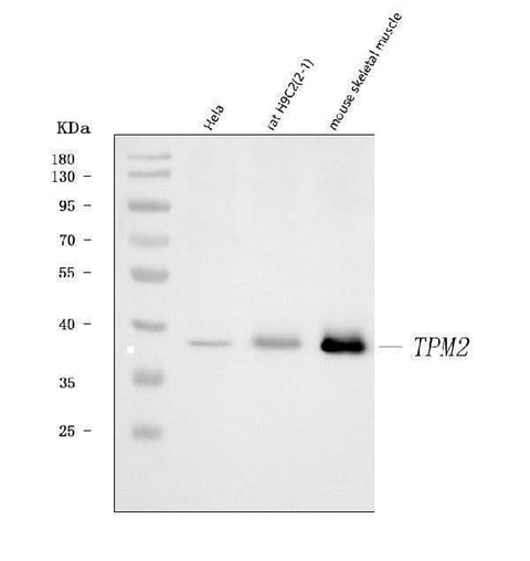 Anti-Tropomyosin 2/TPM2 Antibody Picoband® Boster Bio