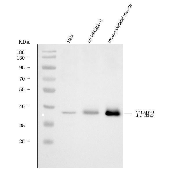Anti-Tropomyosin 2/TPM2 Antibody Picoband® Boster Bio