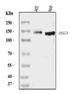 Anti-Desmoglein 3/PVA/DSG3 Antibody Picoband® Boster Bio