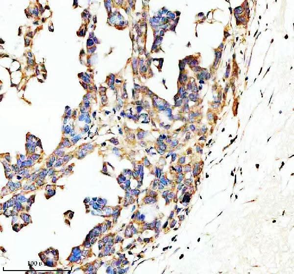 Anti-SPON1 Antibody Boster Bio