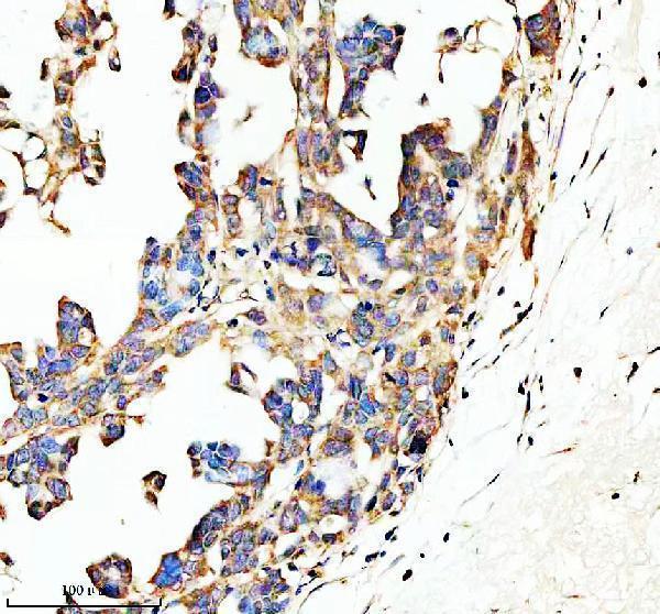 Anti-SPON1 Antibody Boster Bio