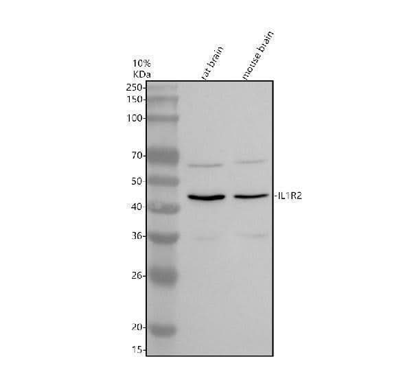 Anti-IL1R2 Antibody Picoband® Boster Bio