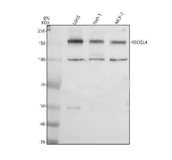 Anti-RECQL4 Antibody Picoband® Boster Bio