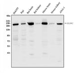 Anti-Clathrin heavy chain/CLTC Antibody Picoband® Boster Bio