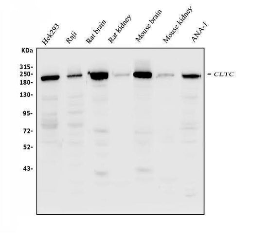 Anti-Clathrin heavy chain/CLTC Antibody Picoband® Boster Bio