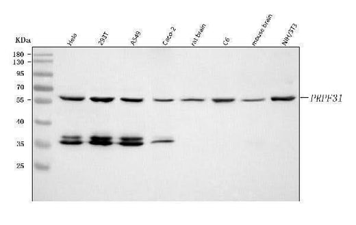 Anti-PRPF31 Antibody Picoband® Boster Bio