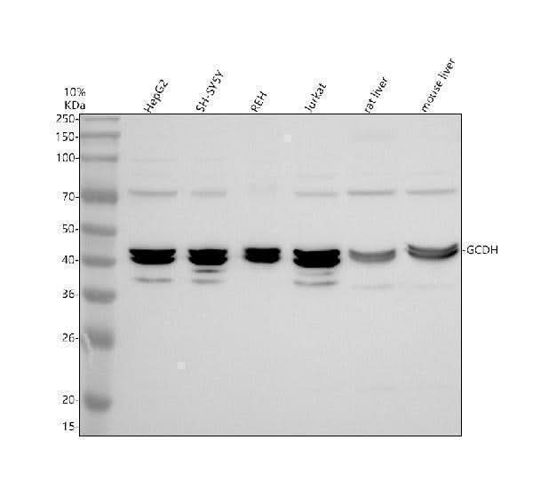 Anti-GCDH Antibody Picoband® Boster Bio