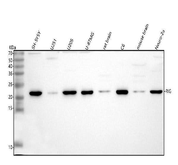 Anti-DKK3/RIG Antibody Picoband® Boster Bio