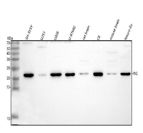 Anti-DKK3/RIG Antibody Picoband® Boster Bio