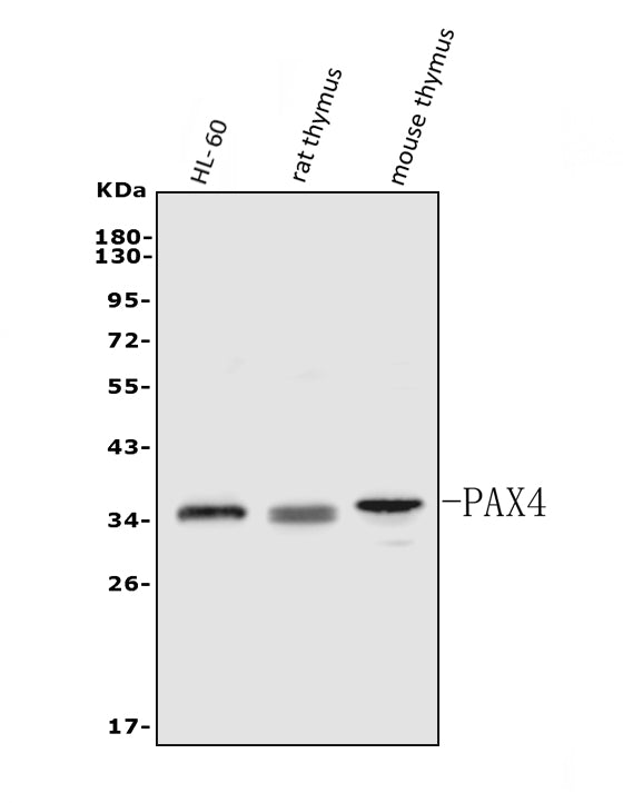 Anti-PAX4 Antibody Picoband® Boster Bio