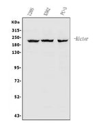 Anti-RICTOR Antibody Picoband® Boster Bio