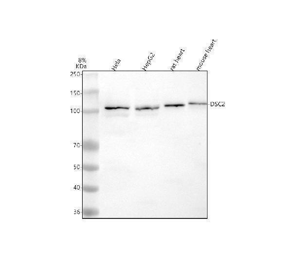 Anti-DSC2 Antibody Picoband® Boster Bio
