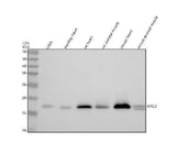 Anti-Myosin Light Chain 2/MLC-2V/MYL2 Antibody Picoband® Boster Bio