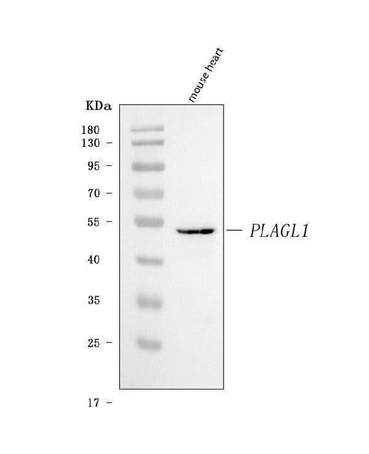 Anti-ZAC/Plagl1 Antibody Picoband® Boster Bio