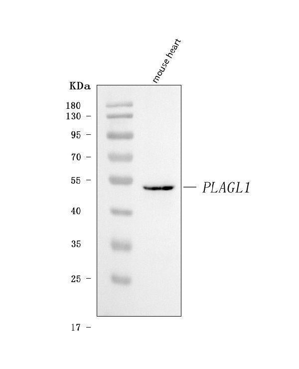 Anti-ZAC/Plagl1 Antibody Picoband® Boster Bio