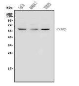 Anti-DR3/Tnfrsf25 Antibody Picoband® Boster Bio