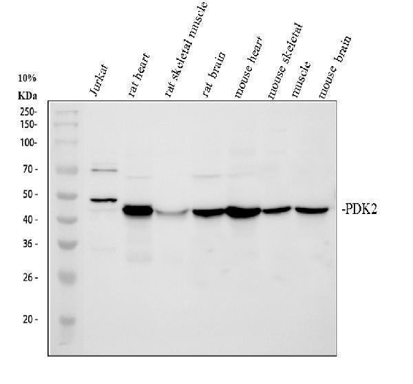 Anti-PDK2 Antibody Picoband® Boster Bio