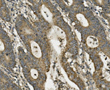 Anti-LRPPRC/GP130 Antibody Picoband® Boster Bio