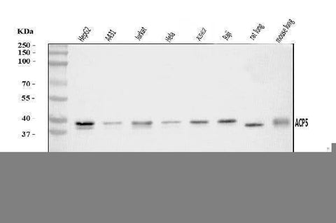 Anti-Acid phosphatase/ACP5 Antibody Picoband® Boster Bio