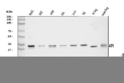 Anti-Acid phosphatase/ACP5 Antibody Picoband® Boster Bio