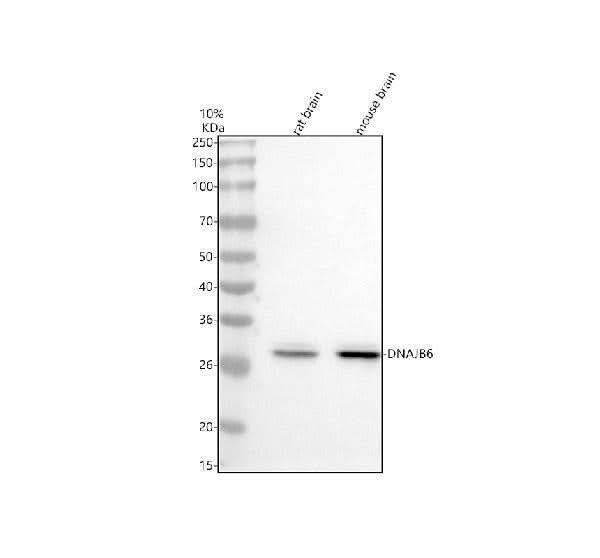 Anti-DNAJB6 Antibody Picoband® Boster Bio