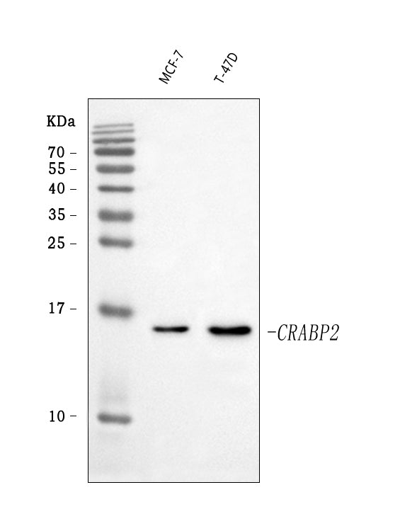 Anti-CRABP2 Antibody Picoband® Boster Bio