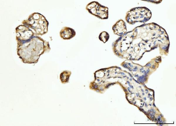 Anti-FGF3 Antibody Boster Bio