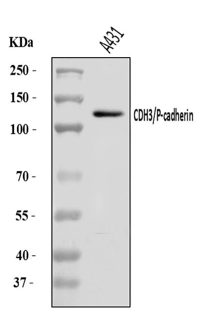 Anti-P cadherin/CDH3 Antibody Picoband® Boster Bio