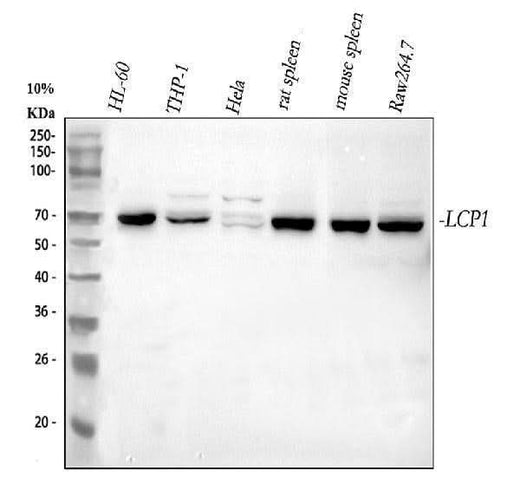 Anti-Plastin L/LCP1 Antibody Picoband® Boster Bio