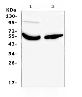 Anti-Vitamin D Binding protein/GC Antibody Picoband® Boster Bio