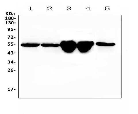 Anti-Vitamin D Binding protein/Gc Antibody Picoband® Boster Bio