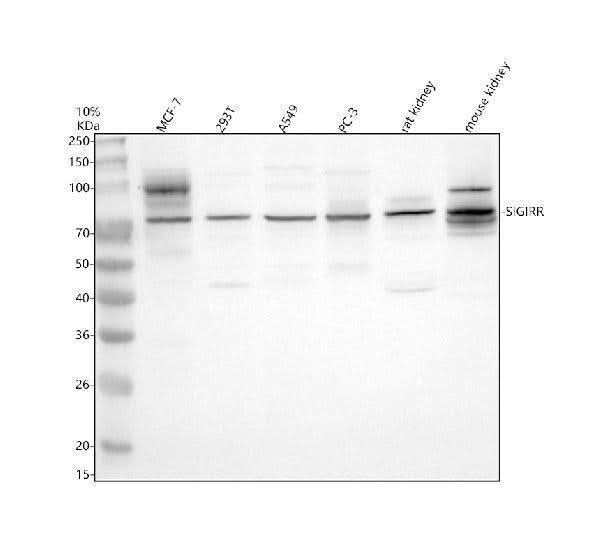 Anti-SIGIRR Antibody Picoband® Boster Bio