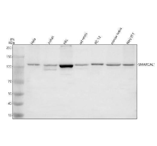 Anti-SMARCAL1 Antibody Picoband® Boster Bio