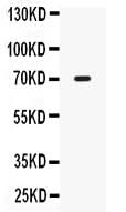 Anti-IL12RB1 Antibody Picoband® Boster Bio