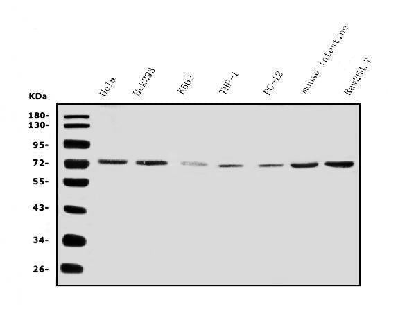 Anti-IL2 Receptor beta/p75/IL2RB Antibody Picoband® Boster Bio