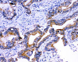 Anti-Stanniocalcin 1/STC/STC1 Antibody Boster Bio