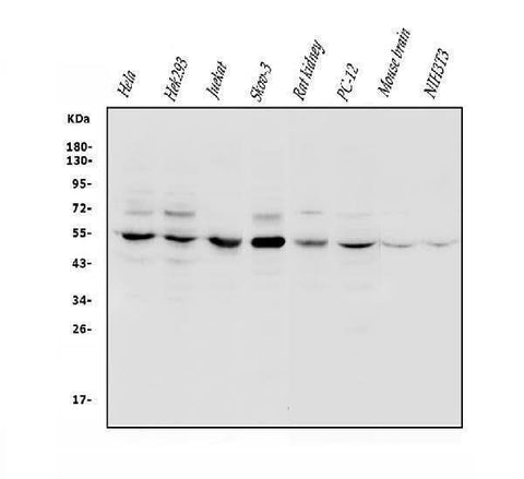 Anti-VPS4B/MIG1 Antibody Picoband® Boster Bio