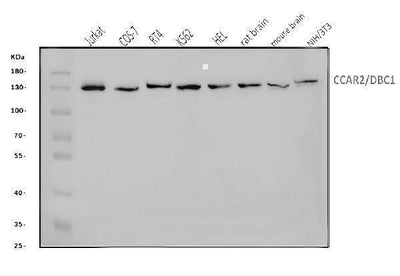 Anti-DBC-1/CCAR2 Antibody Picoband® Boster Bio
