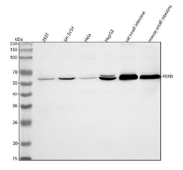 Anti-PEPD Antibody Picoband® Boster Bio