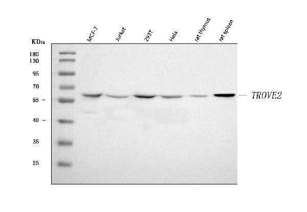 Anti-TROVE2/SS-A/RO60 Antibody Picoband® Boster Bio