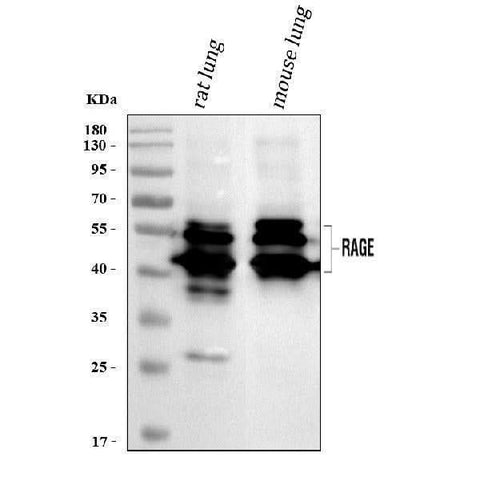 Anti-Ager Antibody Picoband® Boster Bio
