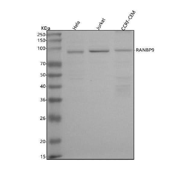 Anti-RANBP9 Antibody Picoband® Boster Bio